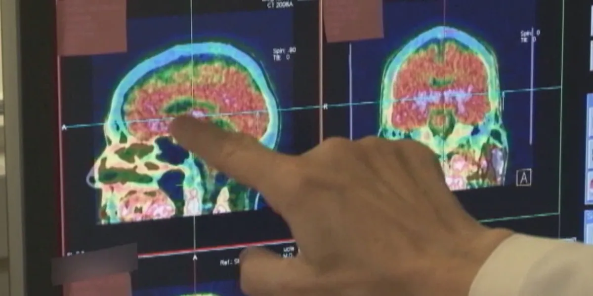 UVA Health launches clinic to diagnose and treat overlooked brain condition