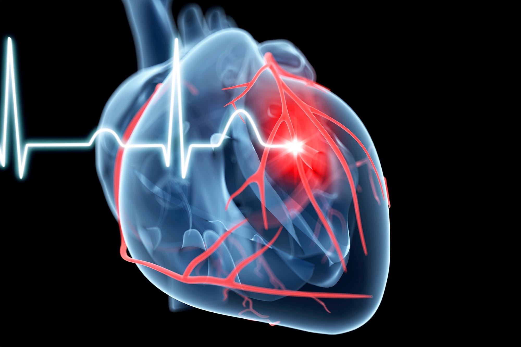 Scientists Tracked 200,000 Diets for 30 Years – Here’s the Real Key to Heart Health