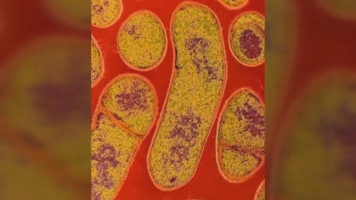 10 suspected botulism cases tied to Botox injections at Milton spa, Mass. health officials say