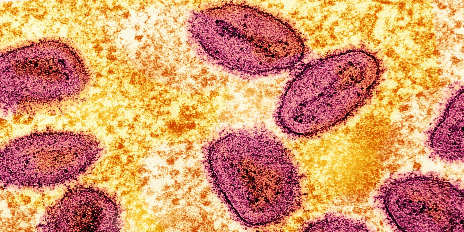 LGBTQ+ health centers lead fight against mpox and stigma nationwide
