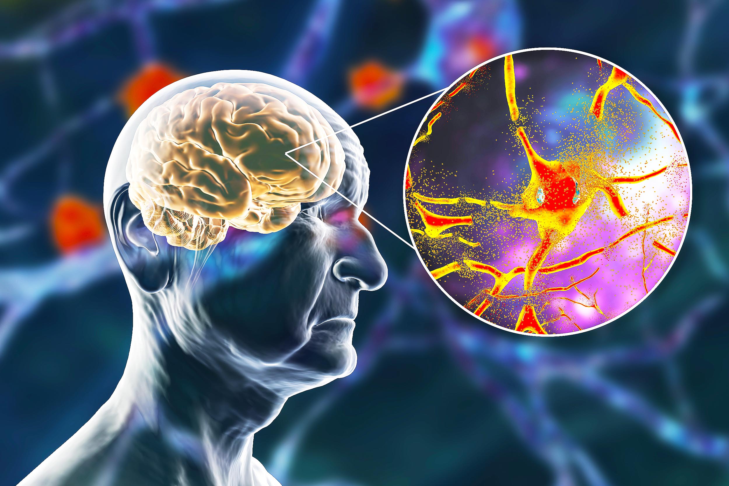 This lifestyle factor is the biggest contributor to cognitive decline