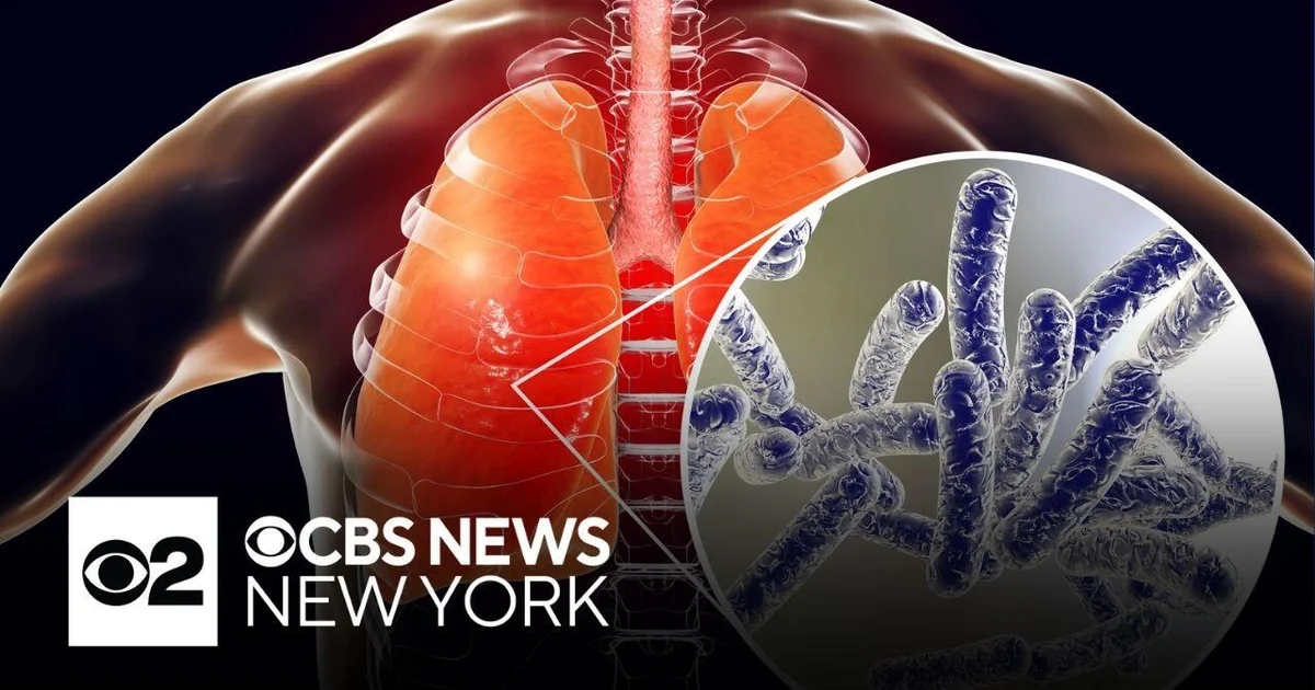 Legionnaires' disease cluster found in Harlem, NYC Health says