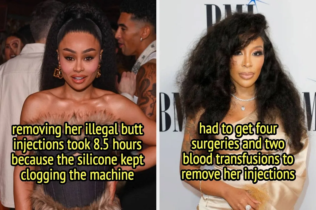13 Celebrities Who Revealed The Shocking Consequences Of Illegal Cosmetic Procedures