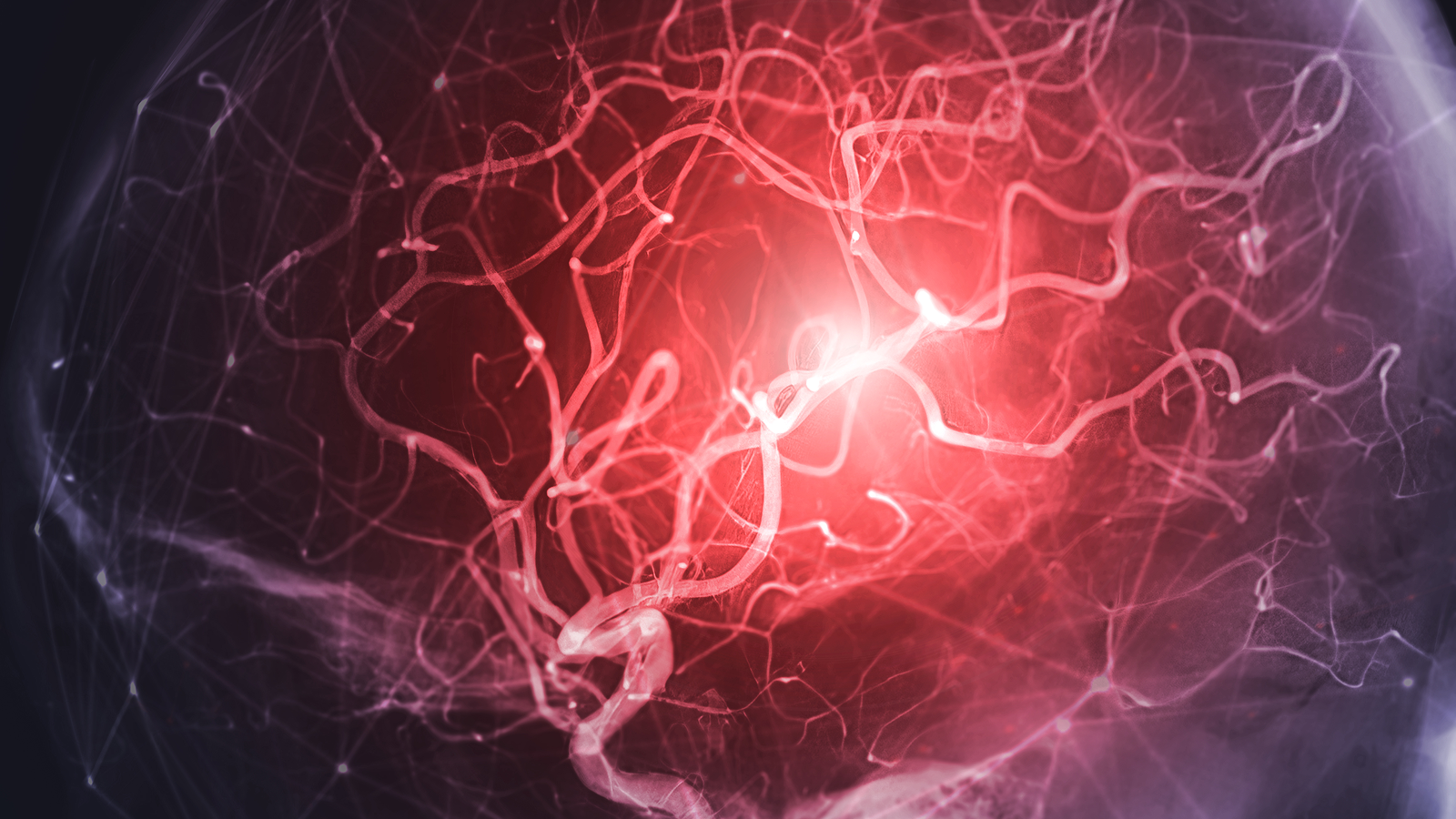 Orgasm involving a kitchen whisk likely triggered person's fatal aneurysm