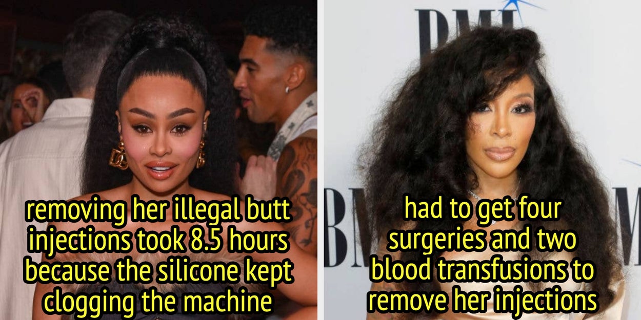 13 Celebrities Who Revealed The Shocking Consequences Of Illegal Cosmetic Procedures
