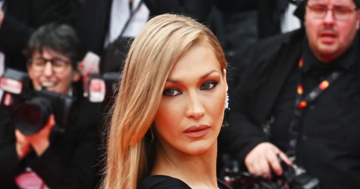 5 Celebrities' Plastic Surgery Confessions Revealed