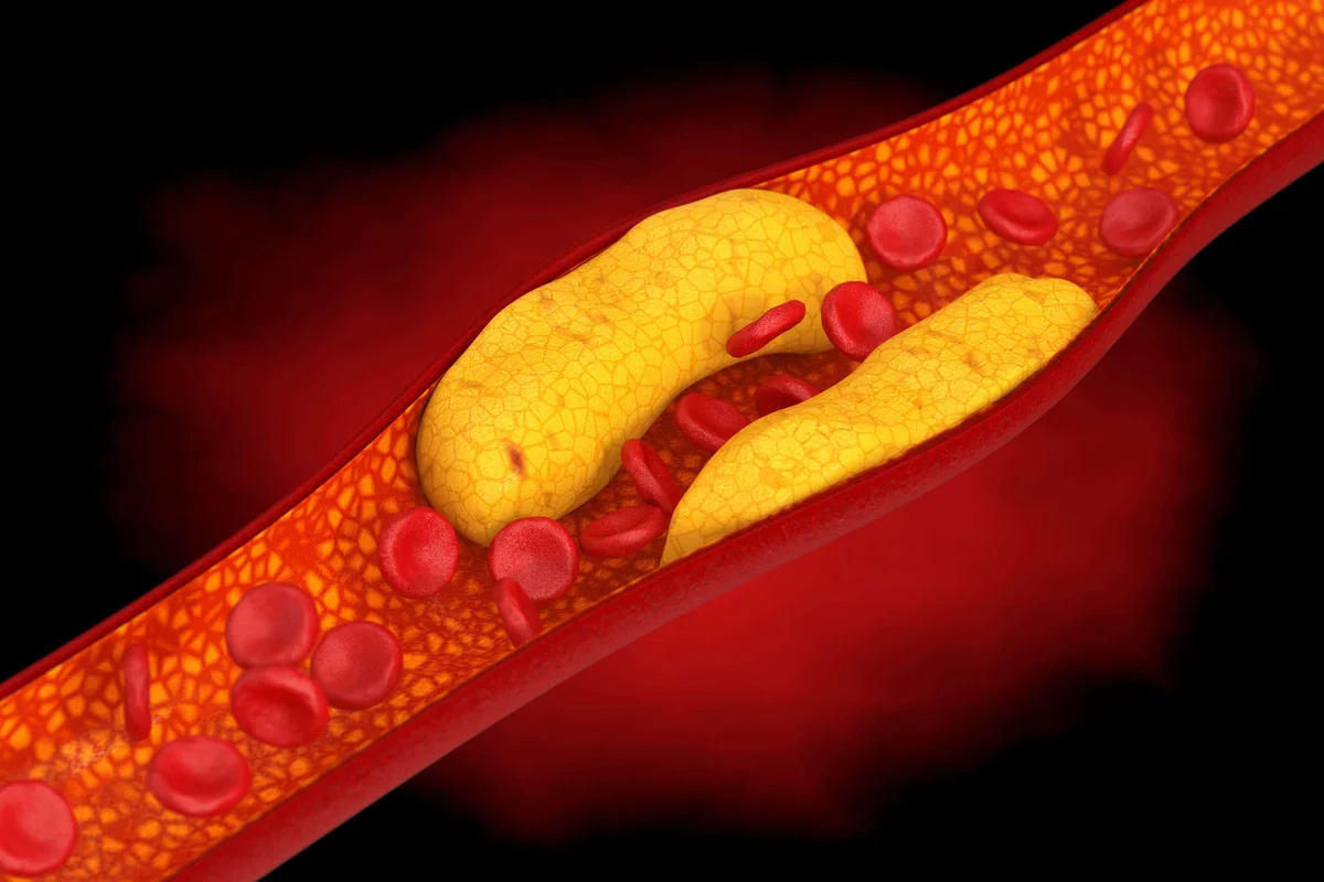 Experts reveal the truth about cholesterol – and how it impacts your health