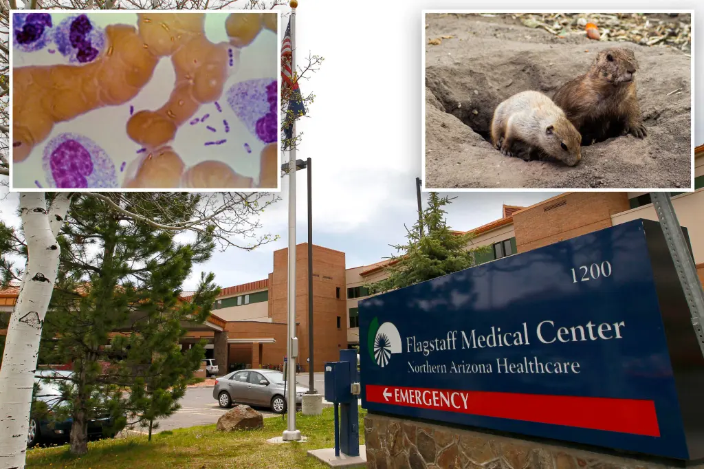 Arizona patient dies of bubonic plague as health officials warn...