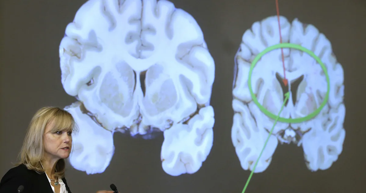 NYC shooter mentioned CTE, accused NFL of concealing its dangers in note. What is it and why does it