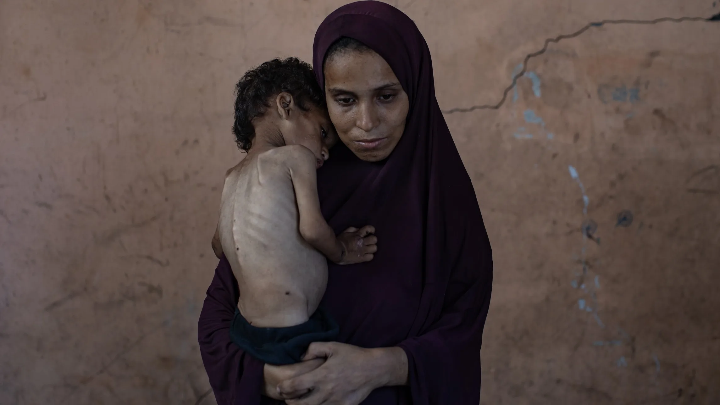 Doctors and health officials report wave of hunger deaths in Gaza