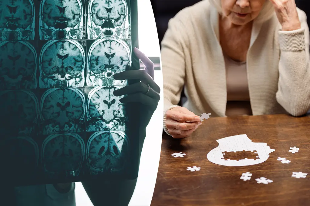Expert reveals 11 lifestyle changes to ward off Alzheimer's
