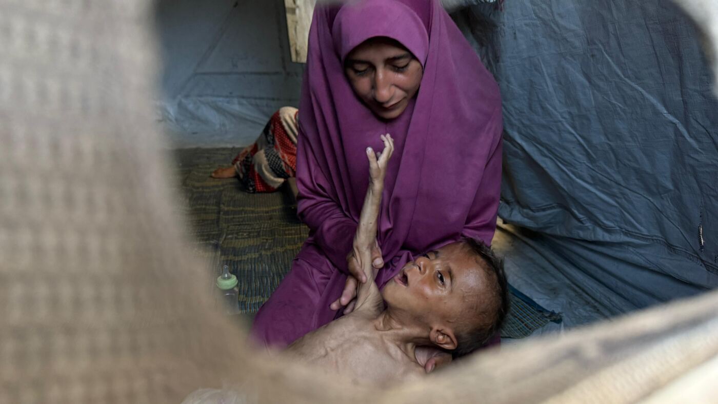His name is Mohammad Al-Motawaq. He is 18 months old. And he is starving in Gaza