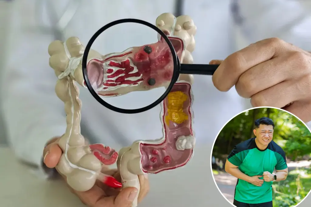 This health nut habit may actually increase your colorectal cancer...